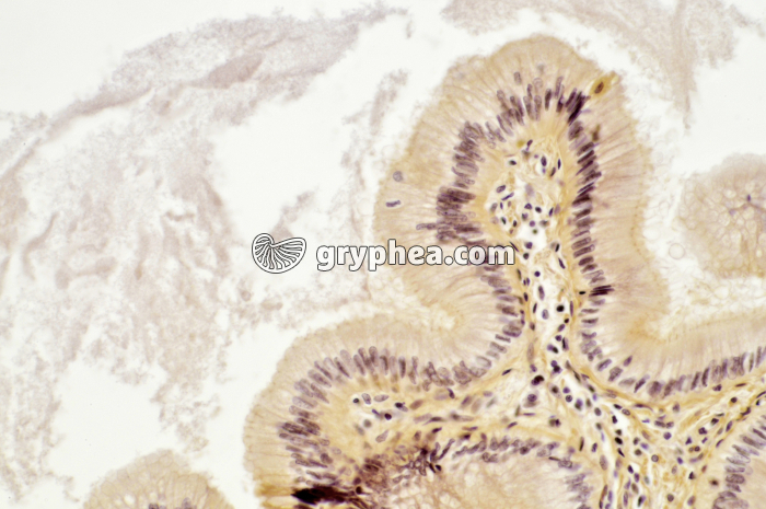 Oesophage Chien x100 - gryphea.org